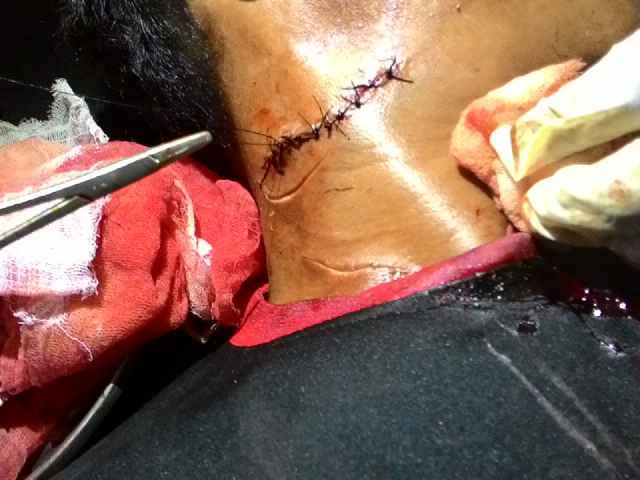 Korban Imam saat dirawat di Puskesmas Jembatan Mas